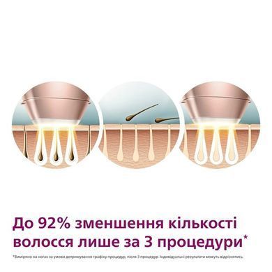 Фото: 27 з 28, Фотоепілятор Philips Lumea IPL 9900 Series, акумуляторний , кіл-ть спалах.-450000, 2-4 см2, насадок-3, футляр, біло-золотий (BRI973/00), купити за 23 999 грн зі знижкою в Смартс | smarts.ua